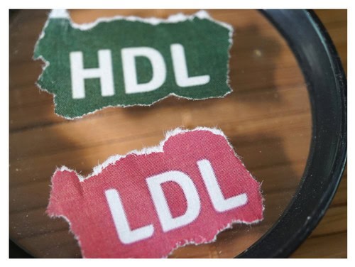 Cholesterol LDL a HDL